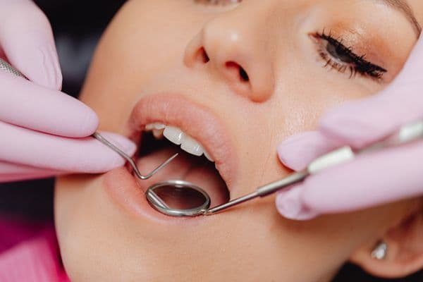 Antes — Clareamento Dental